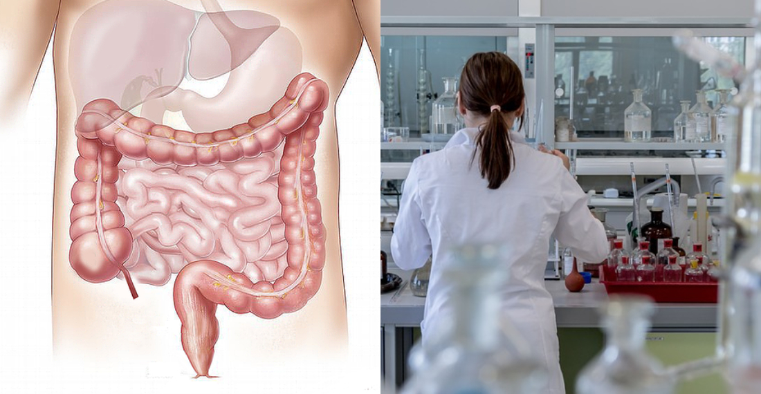 Crean prueba que detecta el cáncer de colon 15 años antes de su aparición